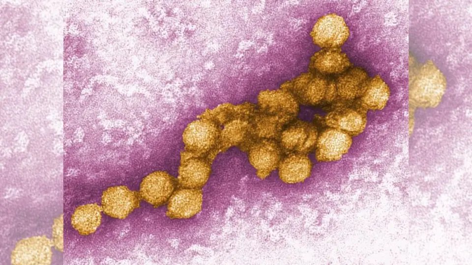 Detectan nuevo caso autóctono de virus del Nilo Occidental e